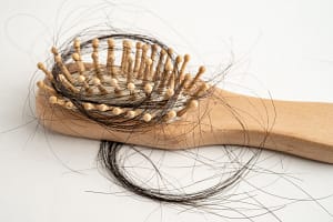 dr bruce marko Hair transplant shock loss