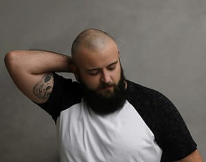 Dr. Bruce Marko signs of hair loss
