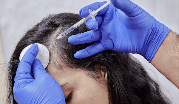 Dr. Bruce Marko Non-Surgical Hair Restoration