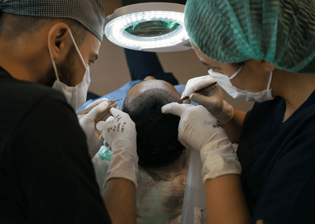 Hair Transplant surgery